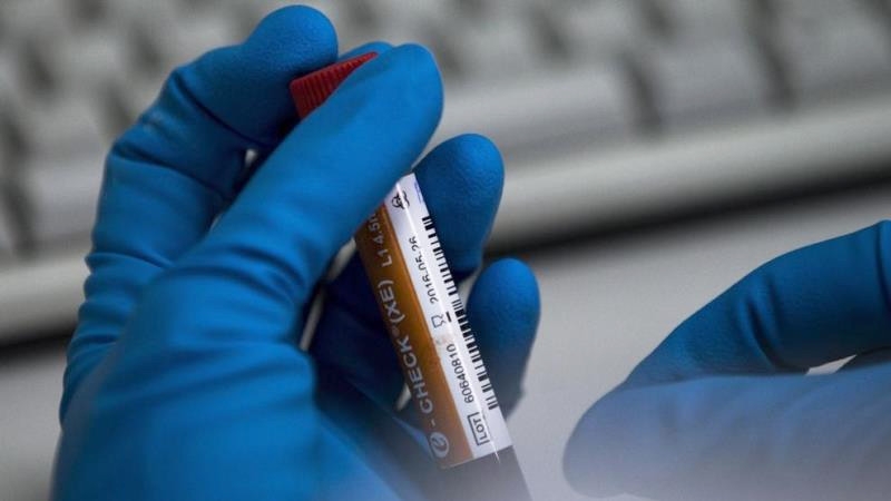 WADA пояснило решение о лишении лицензии Московской антидопинговой лаборатории